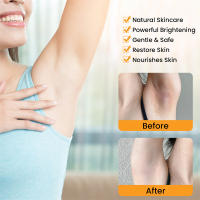Crema Blanqueadora Elimina Melanina, Aclara Tus Piernas, Axilas, Caderas, Manzanas - details 20