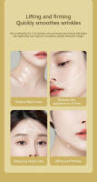 Dispositivo de Belleza Suave para Aliviar la Corneta Terapia Facial para Reafirmar la Piel - details 12