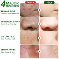 Crema de reducción de poros con ácido salicílico, Reduce los poros grandes, aprieta la refinación, repara los poros ásperos y opacos, ilumina el cuidado de la piel - details 9