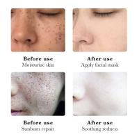 Nicotinamida elimina el melasma, mancha blanca, crema para pecas, aclara la melanina, ilumina el tono de la piel, hidrata el cuidado de la piel facial, maquillaje - details 4