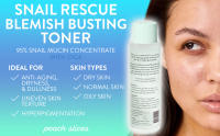 snail rescue toner spotlight image