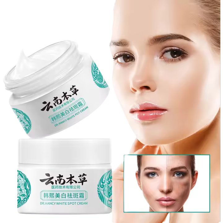 Crema Blanqueadora Herbal 20g Hidratante y Iluminador para la Piel Desvanece Manchas y Pimientos - 1