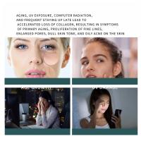 Nueva luz LED de color Instrumento de radiofrecuencia masajeador facial dermapen profesional - details 1