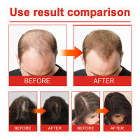 Aceite esencial suave pero hidratante para el cuero cabelludo para un cuidado del cabello grueso, fuerte, flexible, suave y hermoso - details 8
