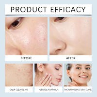 El aceite limpiador para desmaquillar es suave y profundo, calmante para el rostro, los ojos y los labios. Se puede utilizar como transparente y no apretado. - details 11
