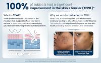skin barrier