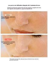 radiofrecuencia facial Súper pulso de alta frecuencia, instrumento de radiofrecuencia EMS microcorriente ojo desvanecimiento líneas finas levantamiento - details 6