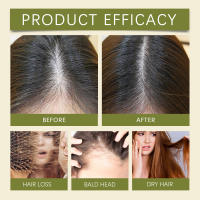 Líquido para el crecimiento del aceite, esencia antipérdida, reparación de humedad gruesa, cabello para aliviar el cabello seco, peludo y sedoso - details 8