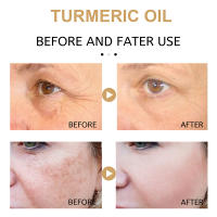 Suero iluminador de cúrcuma, aclara las manchas oscuras, desvanece las arrugas de la cara, aceite esencial blanqueador antienvejecimiento, cuidado de la piel facial, 30ml - details 2