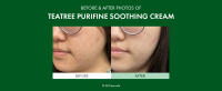 Tea Tree Purifine Cream