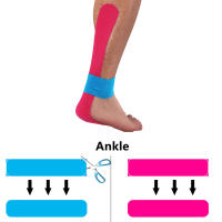 Cinta de kinesiología para deportes, Protector muscular de rodilla, 5cm x 5m - details 7
