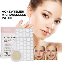 Parches de Tratamiento de Acné de Punto Micro 72 Counts para Tratamiento de Pimientos - details 0