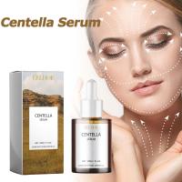 Suero de Centella que nutre la mejora de la piel seca, rejuvenecimiento suavizante, ilumina la hidratación, ácido hialurónico, esencia facial, cuidado de la piel - details 1