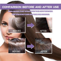 Las gotas de folículos reparan los folículos, nutren las raíces y cuidan el cabello grueso y firme - details 8