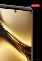 Xundd para VIVO X200 Ultra funda Airbag a prueba de golpes raya trasera cubierta de teléfono transparente con protección de cámara, carcasa acrílica + TPU - details 5