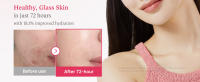 txa serum