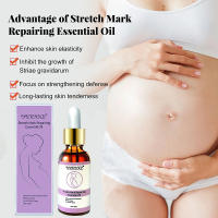 Removedor de estrías, aceite de reparación de cicatrices de maternidad, aceite de tratamiento para el cuidado de la piel, reparación de estrías, mejora la elasticidad, firmeza de la piel - details 0