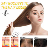 La mascarilla de cuidado con aceite de Batana repara el cabello seco y encrespado, nutritiva, suave, cómoda y reafirmante - details 6