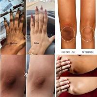 Crema Blanqueadora Effectiva para Piel Oscura Nicotinamida Melanina Cuidado de la Piel Corporal - details 7