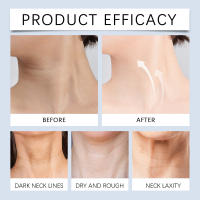 Crema para el cuello firme, 45G, antiarrugas, se desvanecen, líneas finas, reparan daños en la piel, hidratante, forma nutritiva, belleza para el cuello - details 12