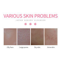 LAIKOU Limpiador facial, lavado facial, elimina puntos negros, hidratante, minimizador de poros, limpieza profunda, control de aceite, cuidado de la piel, 50 g - details 1
