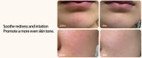 centella serum hydrating toner centella toner korean skin care toner