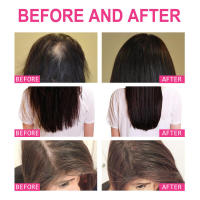 El aceite esencial para hidratar, repara las puntas secas y encrespadas, previene la electricidad estática, suaviza el cuidado y solidifica el cabello. - details 8