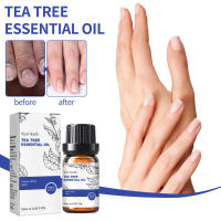 Esencia de árbol de té para reparación de uñas, hidratante para la piel Facial, fijación de cabello denso, aceite esencial multiefecto - details 1