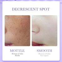 Nicotinamida elimina el melasma, mancha blanca, crema para pecas, aclara la melanina, ilumina el tono de la piel, hidrata el cuidado de la piel facial, maquillaje - details 7