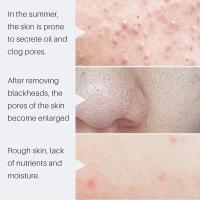 Crema Reductora de Poros de Ácido Salicílico Adiós a los Pulgares, Reparación de Piel, Estiramiento - details 10