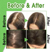 Reparación de raíces líquidas nutritivas, línea gruesa, anticaída y bola fijadora para el cuidado del cabello - details 7