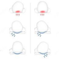 Almohada para ayudar a prevenir y tratar las deformidades de la inclinación de la cabeza, almohada de cuna para recién nacidos, cojín ergonómico para bebés, almohada osito con funda extraíble - details 5