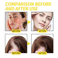 El aceite de semilla negra puede mejorar la irritación seca, nutrir, reparar, dañar, prevenir la pérdida, el cabello denso y la esencia. - details 8