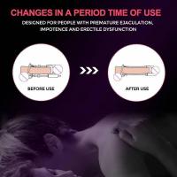Extensor de borde para agrandar dispositivo, potenciador de pene ajustable, Juguetes sexuales de crecimiento para hombres, entrenador duradero con retraso - details 6