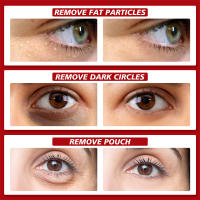 Crema para ojos eliminadora de gránulos de grasa, elimina las ojeras, bolsas para los ojos, desvanece las líneas finas, antihinchazón, arrugas, levanta el cuidado de la piel de los ojos reafirmante - details 0