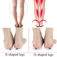 EiD-almohadilla ortopédica para el talón, Gel de silicona para las piernas XO, varius ortopédico, alivio del dolor de fascitis Plantar, plantillas de inserción para el cuidado de los pies - details 21