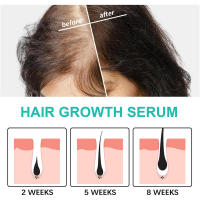 Jayswing Dense Essence repara, hidrata, cabello seco y encrespado, previene el cuidado del cabello para un cabello fuerte, firme y grueso. - details 5