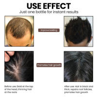 Essence Nutrition Root Nourishing Care Aceite esencial para fortalecer el cabello - details 8