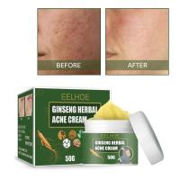 EELHOE-crema de tratamiento de Ginseng a base de hierbas, Reduce las cicatrices, Control de aceite, hidratante, reduce los poros naturales, loción facial para el acné - details 2