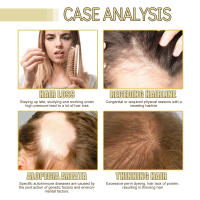 Aceite esencial de romero para reparar, suavizar, nutrir y brillo el cabello - details 4