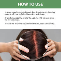 Cuidado de la oliva que alivia el enrojecimiento del cuero cabelludo, repara los folículos de acné, la picazón y la esencia para cabello apretado. - details 3