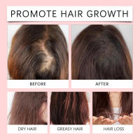 El aceite de Batana nutre, suaviza, repara el cabello seco y encrespado y cuida los aceites esenciales. - details 8