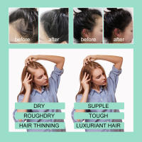 El romero nutre suavemente ilumina el cabello, hidrata y suaviza el aceite esencial para el cuidado del cabello - details 6