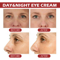 Bolsa para ojos instantánea, crema para eliminar ojos, líneas finas, partículas antigrasa, ojeras, hinchazón, levanta, ilumina el cuidado de los ojos coreano, nuevo - details 11
