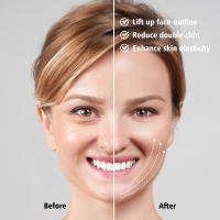 Masajeador Facial de Microcorriente Dispositivo de Levantamiento Facial de Radiofrecuencia - details 1
