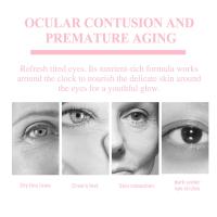 Nueva crema de ojos Retinol para estiramiento facial, bálsamo hidratante en barra, antiarrugas, antihinchazón, elimina las ojeras, bolsas para los ojos, cuidado - details 11