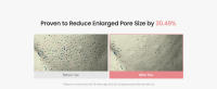 New_Proven Pore Improvement