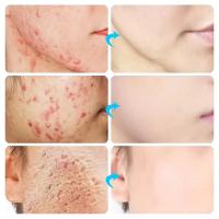 Crema facial de gelatina de 100g, SPA suave de colágeno, hidratante nutritiva, reduce los poros, elimina los Comedones, esencia de gelatina, cuidado de la piel coreano - details 1