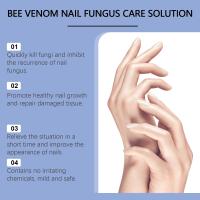 Solución para el cuidado de las uñas, Esencia para el cuidado de los hongos, Eliminación de la tiña, Gel antimicótico - details 6