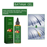 Batana esencial para reparar, fortalecer, reafirmar, prevenir la caída y nutrir el aceite para el cabello del cuero cabelludo - details 6